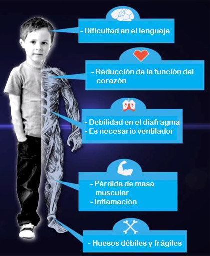 duchenne