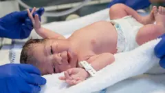 Reci&eacute;n nacido. Foto Bolet&iacute;n informativo del &Aacute;rea de Salud de Tudela