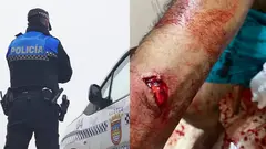 Corte en el brazo con una botella. Foto Polic&iacute;a Local de Tudela