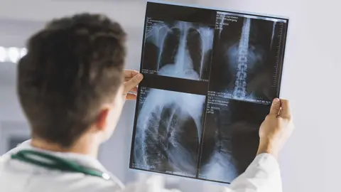 Radiólogo observando una radiografía. Foto de archivo