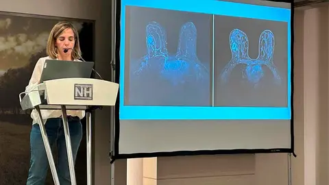 La doctora Susana de la Cruz, oncóloga médica del HUN