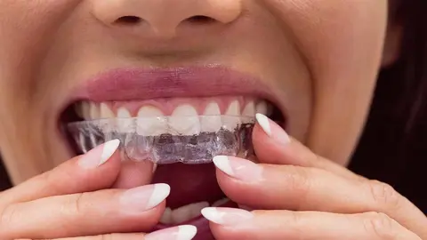 dentista invisalign Foto Freepik