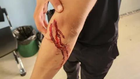 Corte sangrante en el brazo de un joven. foto Polic&iacute;a Local de Tudela