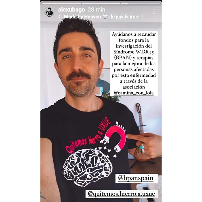 Alex Ubago apoya a los enfermos BPAN